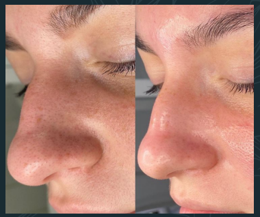 HIDRATACION INTENSA - Imagen 3