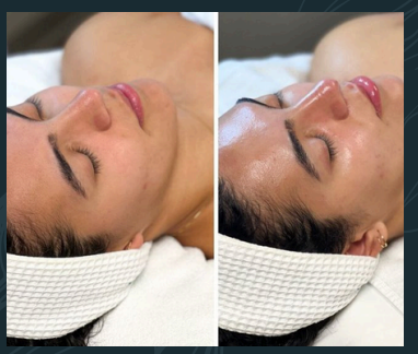 HIDRATACION INTENSA - Imagen 2