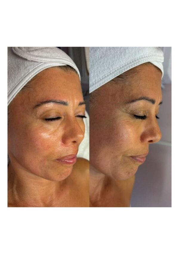 NUTRITIVO ANTI- EDAD