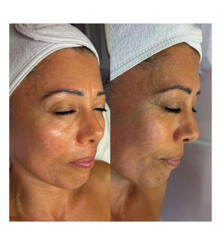 NUTRITIVO ANTI- EDAD