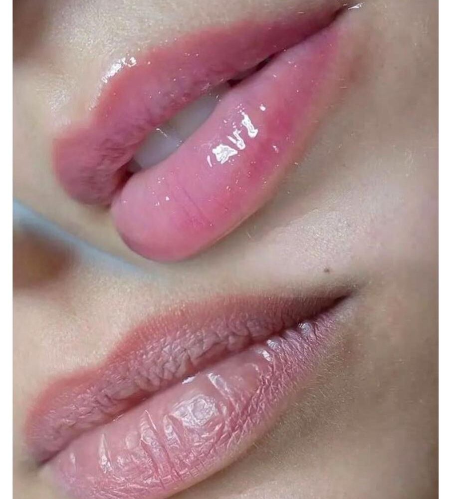 HYDRA LIPS